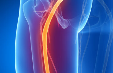 sciatique – Sciatalgie – Alexandre Hryb – etiopathe Cogolin – Saint Tropez – Sainte Maxime – Le Lavandou – La Londe sciatique - Sciatalgie - Alexandre Hryb - etiopathe Cogolin - Saint Tropez - Sainte Maxime - Le Lavandou - La Londe