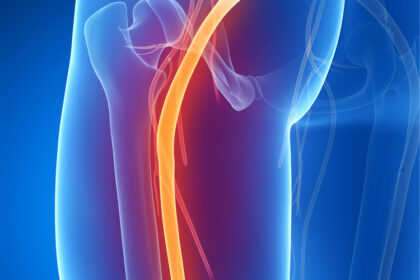 sciatique - Sciatalgie - Alexandre Hryb - etiopathe Cogolin - Saint Tropez - Sainte Maxime - Le Lavandou - La Londe