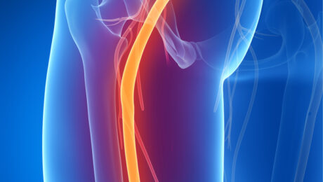 sciatique – Sciatalgie – Alexandre Hryb – etiopathe Cogolin – Saint Tropez – Sainte Maxime – Le Lavandou – La Londe sciatique - Sciatalgie - Alexandre Hryb - etiopathe Cogolin - Saint Tropez - Sainte Maxime - Le Lavandou - La Londe