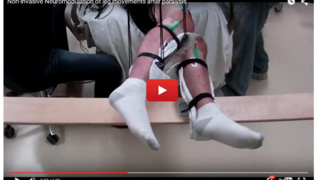 paralysie-stimulateur électrique- paraplégie-Alexandre Hryb – etiopathe Cogolin – Saint Tropez – Sainte Maxime – Le Lavandou – La Londe paralysie-stimulateur électrique- paraplégie-Alexandre Hryb - etiopathe Cogolin - Saint Tropez - Sainte Maxime - Le Lavandou - La Londe